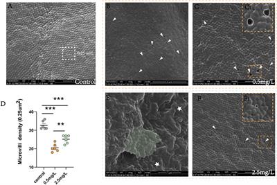 Ammonia nitrogen stress damages the intestinal mucosal barrier of yellow catfish (Pelteobagrus fulvidraco) and induces intestinal inflammation